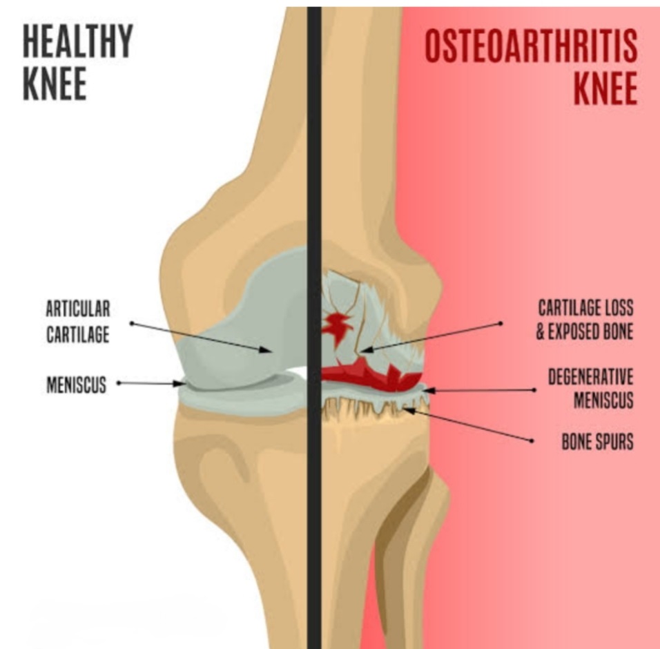 Treatment Image
