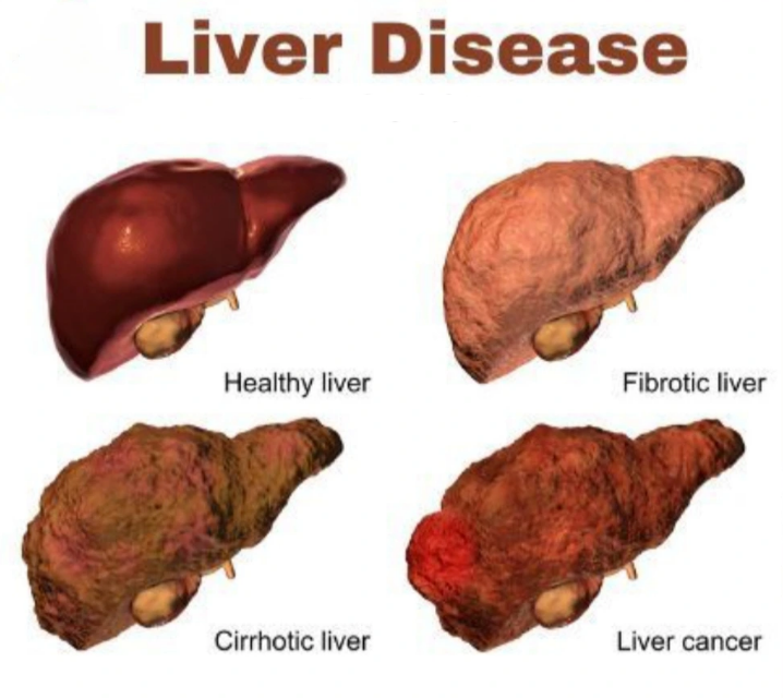 Treatment Image